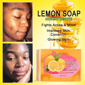 AILKE Dark Spots and Acne Remover Soap